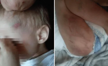 Сожитель алматинки избил ее 3-летнего ребенка 