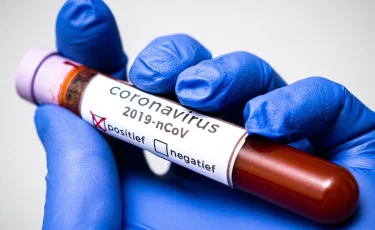 Уже 65 188: в Казахстане зарегистрировано еще 1 674 случая COVID-19