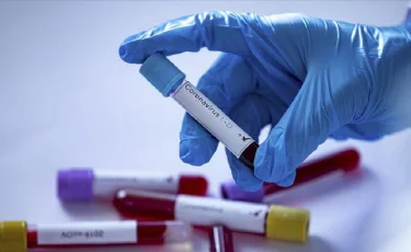 Еще 108 случаев COVID-19 выявлено в Казахстане