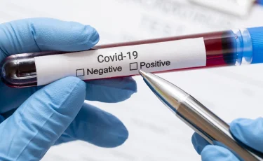 Уже 109 406: в Казахстане зарегистрировано еще 104 случая COVID-19