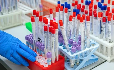 Коронавирус в Казахстане: количество зараженных за прошедшие сутки выросло до 1264