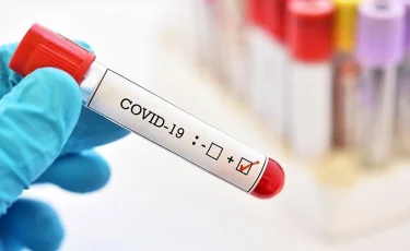 COVID-19 в Казахстане: продолжается рост количества заболевших за сутки