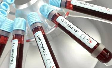 COVID-19 в Казахстане: Карагандинская область в лидерах по количеству зараженных за сутки