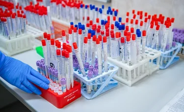 БАҚ: Бүкіл әлемде балалар RSV вирусымен жаппай ауыра бастады